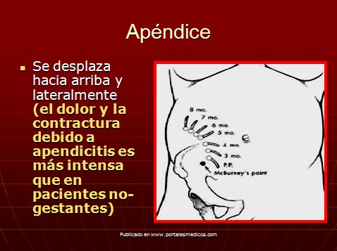 cambios_embarazo/cambios_apendice_apendicitis_embarazo cambios_embarazo/cambios_apendice_apendicitis_embarazo