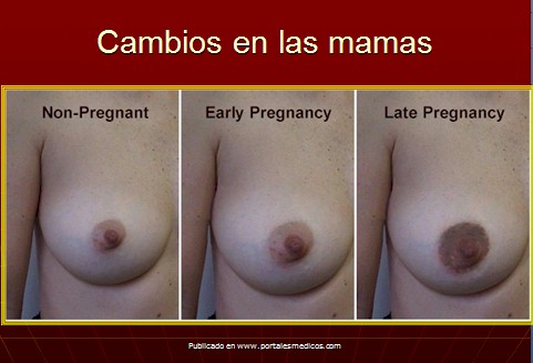 Sintomas De Los Primeros 3 Meses De Embarazo
