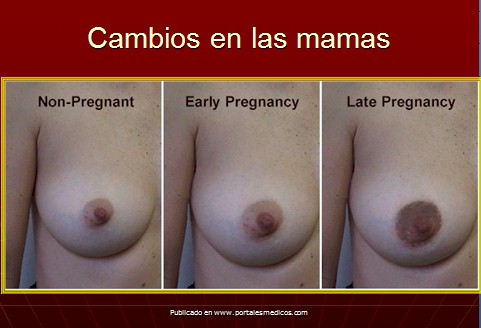 cambios_embarazo/cambios_mamas_embarazo