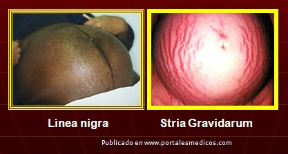 cambios_embarazo/cambios_piel_embarazo_2 cambios_embarazo/cambios_piel_embarazo_2