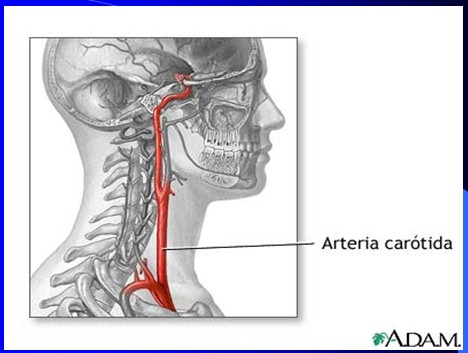 cefaleas_cefalalgias_cefalalgia/cefalea_arteria_carotida
