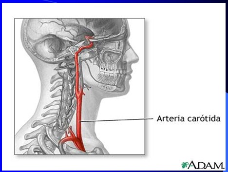 cefaleas_cefalalgias_cefalalgia/cefalea_arteria_carotida cefaleas_cefalalgias_cefalalgia/cefalea_arteria_carotida