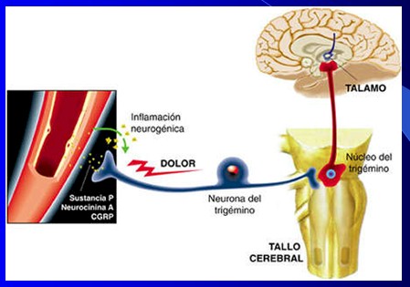 cefaleas_cefalalgias_cefalalgia/cefalea_fisiopatologia