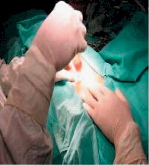 caso_clinico/empiema_drenaje_cultivo caso_clinico/empiema_drenaje_cultivo