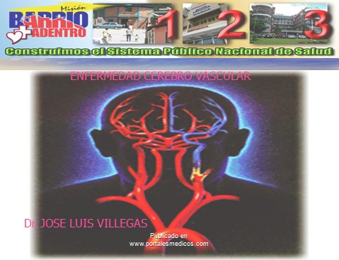 enfermedad_cerebrovascular/ACV_accidente_cerebrovascular