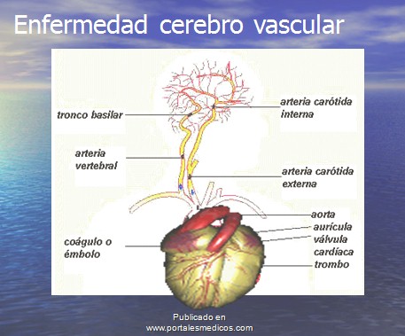 enfermedad_cerebrovascular/ACV_anatomia_vascular