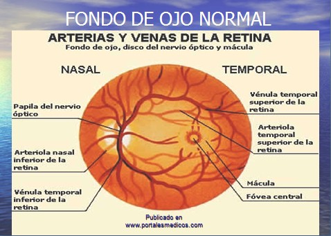 enfermedad_cerebrovascular/ACV_fondo_ojo_normal