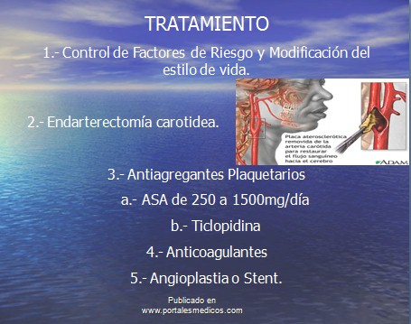 enfermedad_cerebrovascular/ACV_tratamiento