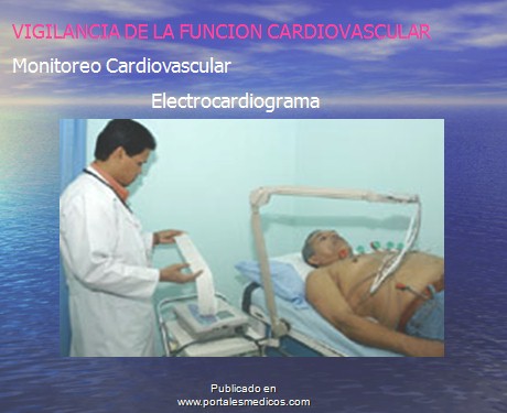 enfermedad_cerebrovascular/ACV_vigilancia_cardiovascular