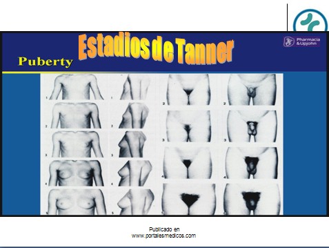 fisiologia_reproductiva/pubertad_estadios_tanner