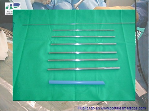litotricia_percutanea/nefrolitotricia_percutanea_materiales_quirofano litotricia_percutanea/nefrolitotricia_percutanea_materiales_quirofano