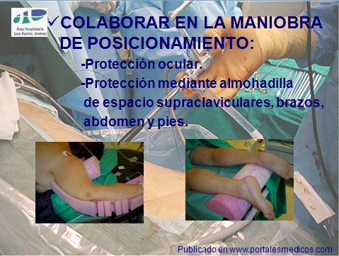 litotricia_percutanea/nefrolitotricia_percutanea_postura_posicion litotricia_percutanea/nefrolitotricia_percutanea_postura_posicion