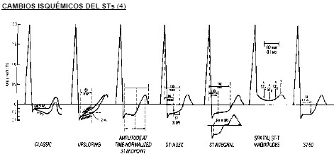 manual_cardiologia_pautas/cambios_isquemicos_segmento_ST