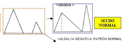 manual_cardiologia_pautas/ecocargiografia_flujo_transmitral_2