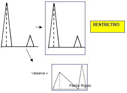 manual_cardiologia_pautas/ecocargiografia_flujo_transmitral_3