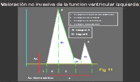 manual_cardiologia_pautas/funcion_diastolica_VI_flujo_transmitral manual_cardiologia_pautas/funcion_diastolica_VI_flujo_transmitral