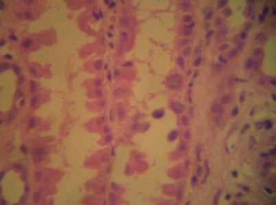 nefropatia_BK_VBK/tx_trasplante_celulas_tubulares_infeccion_viral nefropatia_BK_VBK/tx_trasplante_celulas_tubulares_infeccion_viral