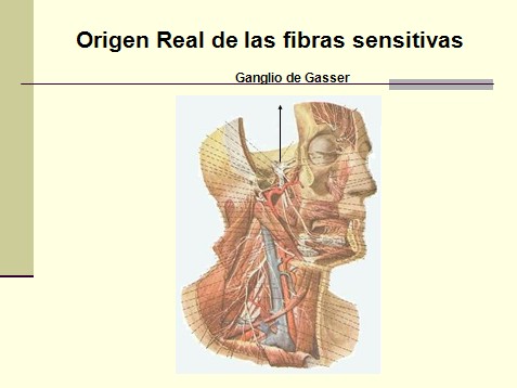 Neuralgia Del Trigémino (Tic de Douloureux)