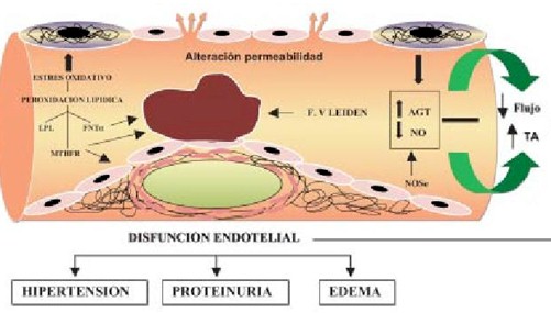 preeclamsia/disfuncion_endotelial_preeclampsia