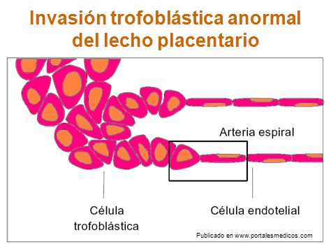 preeclamsia/invasion_trofoblastica_lecho_placentario