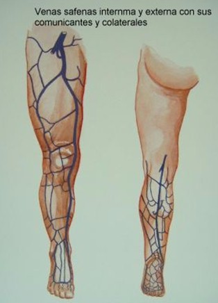 safenectomia_variz/varices_safena_interna_externa_comunicantes safenectomia_variz/varices_safena_interna_externa_comunicantes