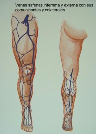 safenectomia_variz/varices_safena_interna_externa_comunicantes