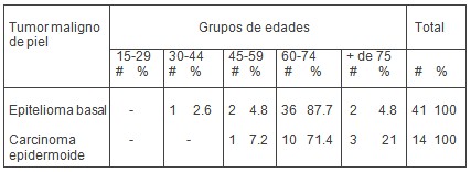 tumores_malignos_piel/epitelioma_basal_carcinoma_epidermoide_2