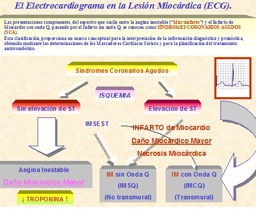 marcadores_cardiacos_isquemia/ecg_electrocardiograma_lesion_miocardica