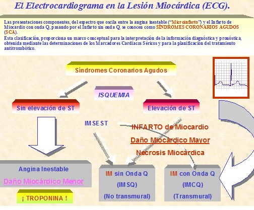 marcadores_cardiacos_isquemia/ecg_electrocardiograma_lesion_miocardica marcadores_cardiacos_isquemia/ecg_electrocardiograma_lesion_miocardica