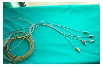manejo_paciente_quirofano/colocacion_electrodos_ECG_EKG_electrocardiograma