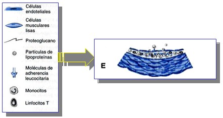 marcadores_cardiacos/patogenia_arteriosclerosis_ateromatosis_5