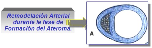 marcadores_cardiacos/remodelacion_arterial_ateroma