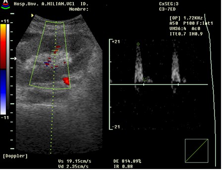 Ecografia Abdominal Embarazo Pdf