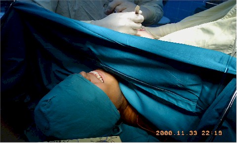 analgesia_acupuntural_cirugia_mama3 analgesia_acupuntural_cirugia_mama3
