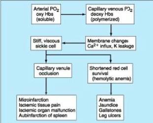 anemia_drepanocitica