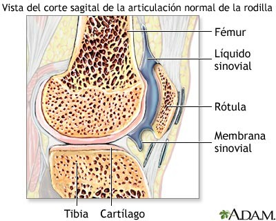artritis_reumatoid_articulacion_rodilla