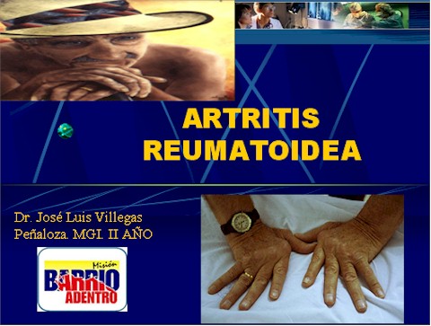 artritis_reumatoide