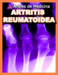 artritis_reumatoide2