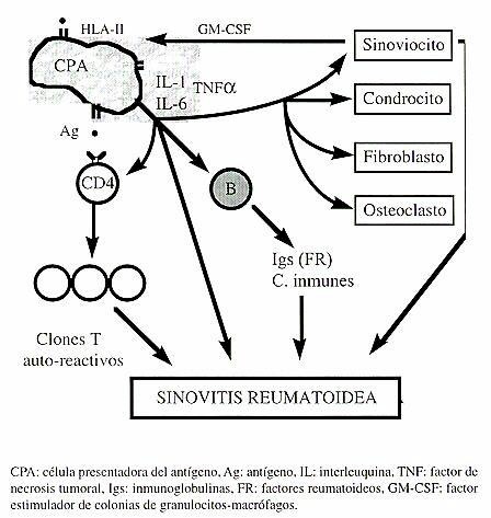 artritis_reumatoide4 artritis_reumatoide4