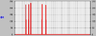 astrocitoma_Componente_B1