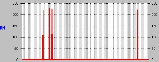 astrocitoma_Componente_R1