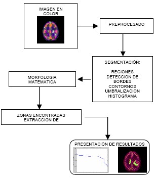 astrocitoma_analisis_imagen