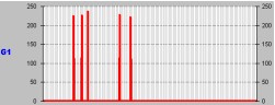 astrocitoma_resultados10 astrocitoma_resultados10