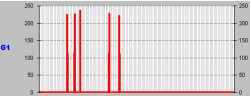 astrocitoma_resultados10