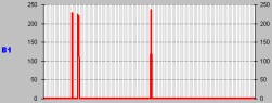 astrocitoma_resultados11