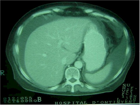 parenquima_hepatico parenquima_hepatico