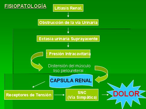 colico renal