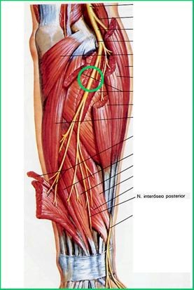 epicondilitis_anatomia epicondilitis_anatomia