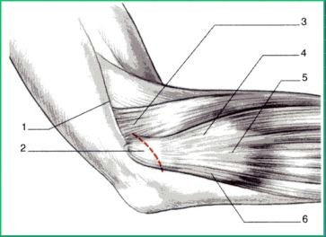 epicondilitis_tecnica_hohmann epicondilitis_tecnica_hohmann
