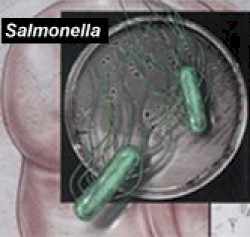 fiebre_tifoidea_salmonella